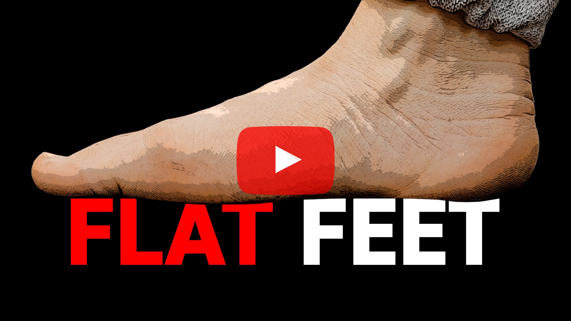 Rethinking Flat Feet