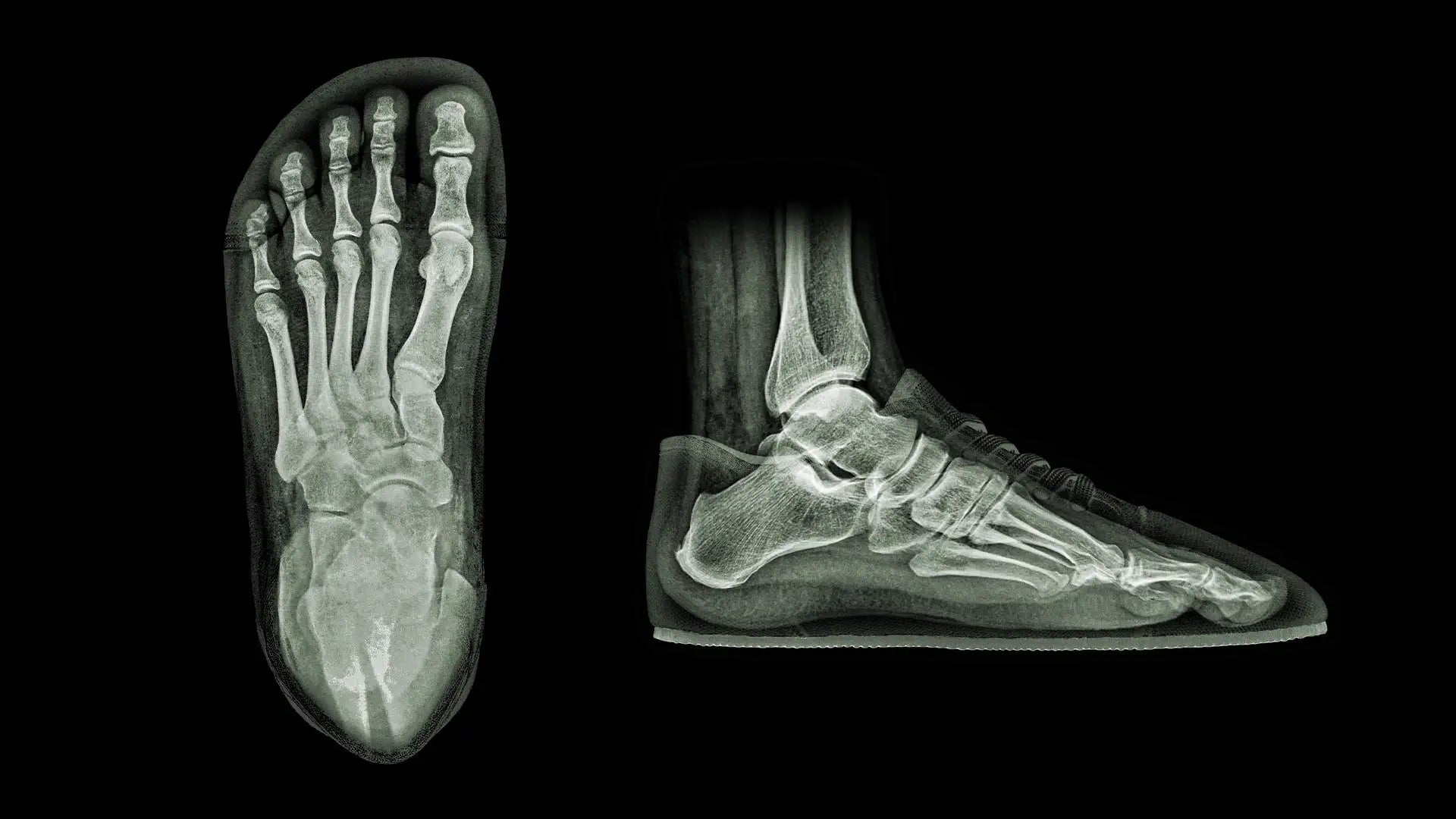 3d printed foot model with intricate bone structure, black background.